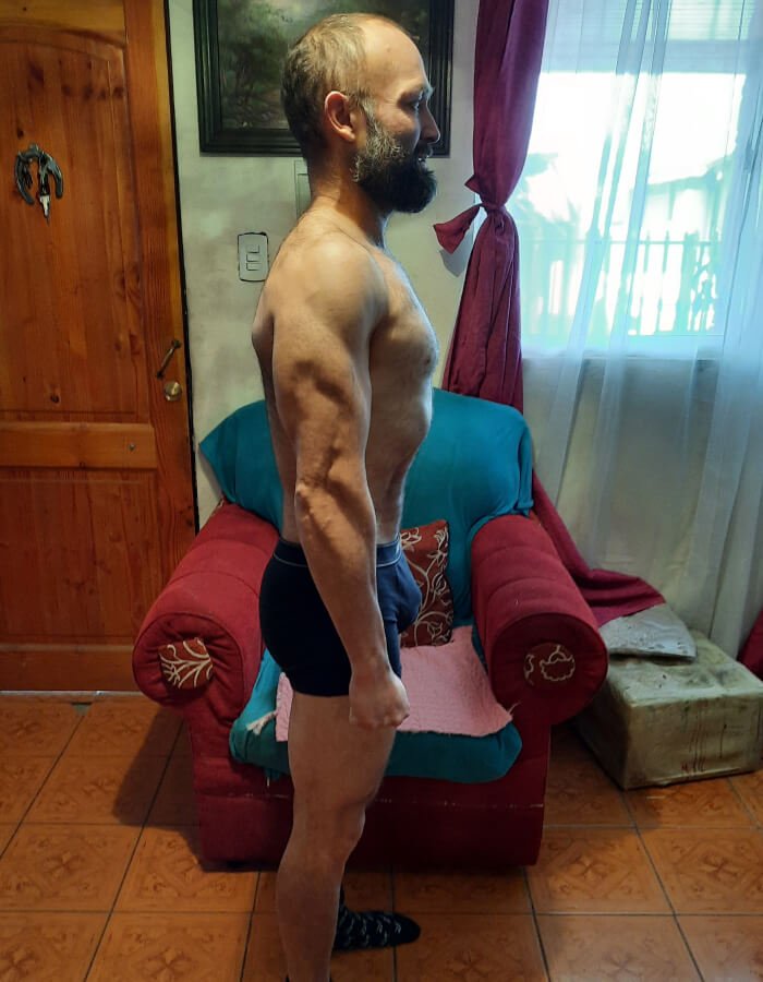 Carlos-despues-2