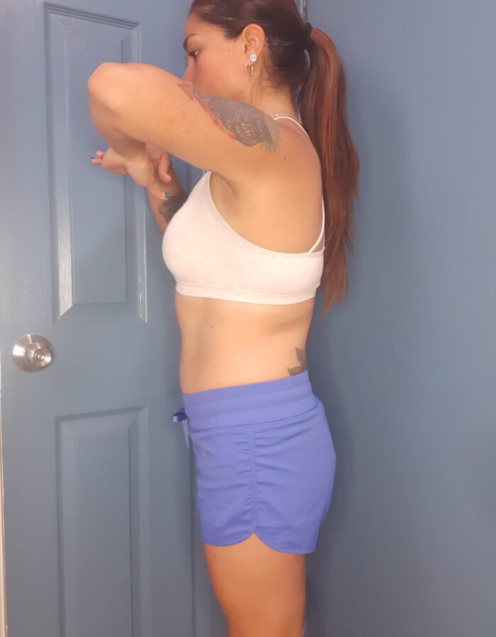 Romina-antes-2